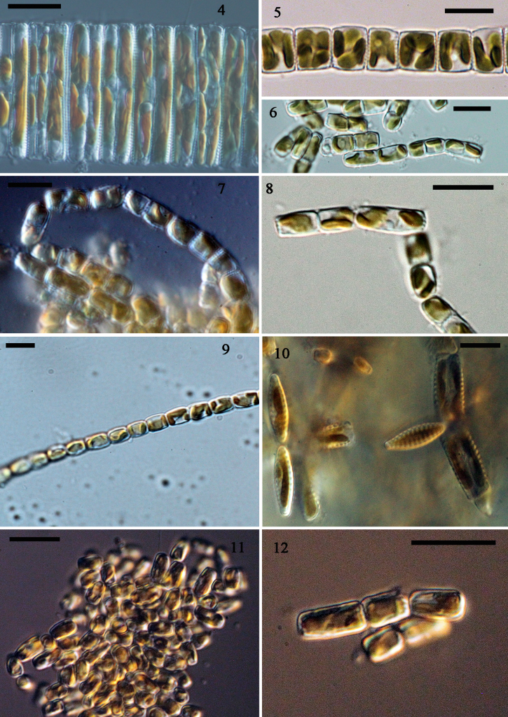 “The morphology and molecular phylogenetics of some marine diatom taxa within the Fragilariaceae, in... 사진